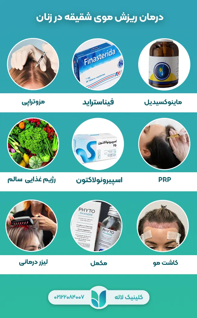 درمان ریزش موی شقیقه در زنان