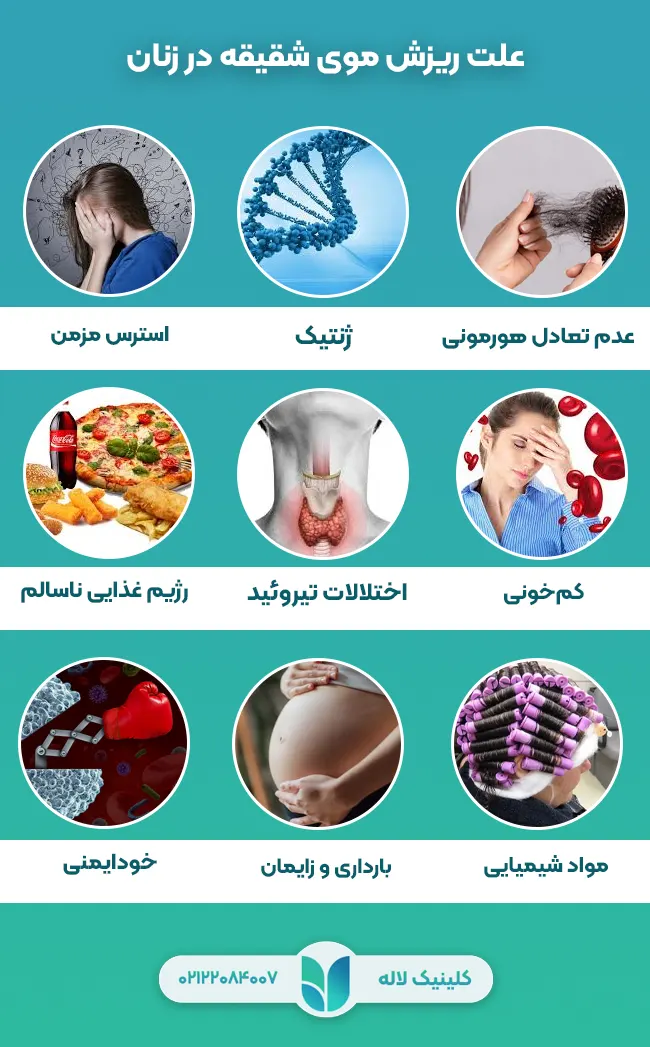 علت ریزش موی شقیقه در زنان