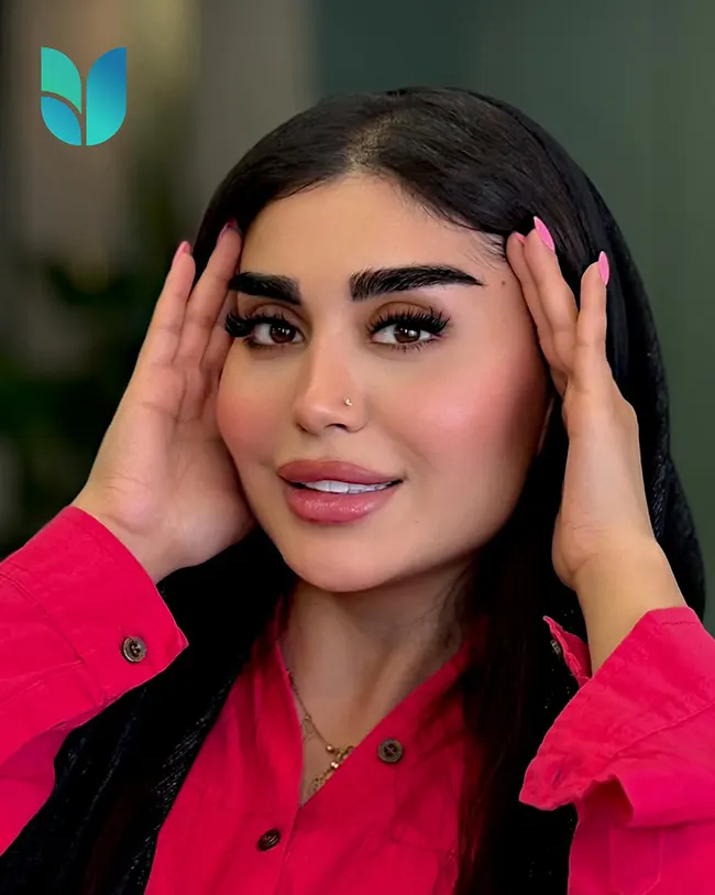 کاشت ابرو جوان پسند