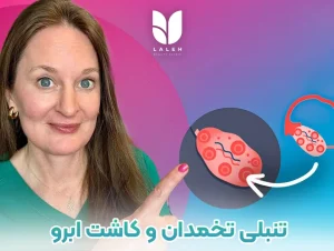 تنبلی تخمدان و کاشت ابرو