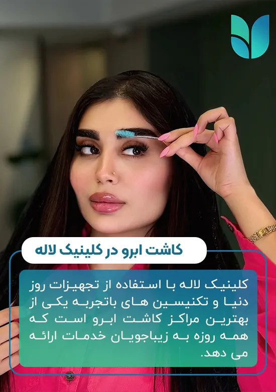 کاشت ابرو
