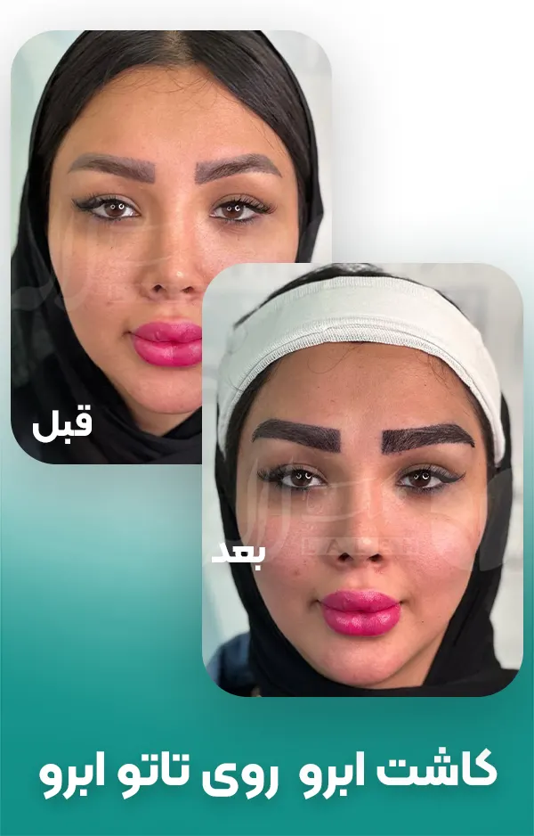 کاشت ابرو روی تاتو ابرو