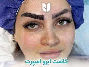 کاشت ابرو مدل اسپرت و جوان پسند