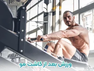 ورزش بعد از کاشت مو