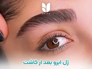 همه چیز درباره ژل ابرو بعد از کاشت