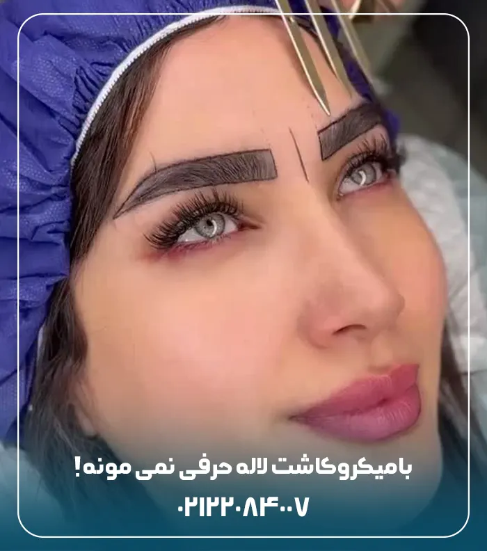 میکرو کاشت ابرو