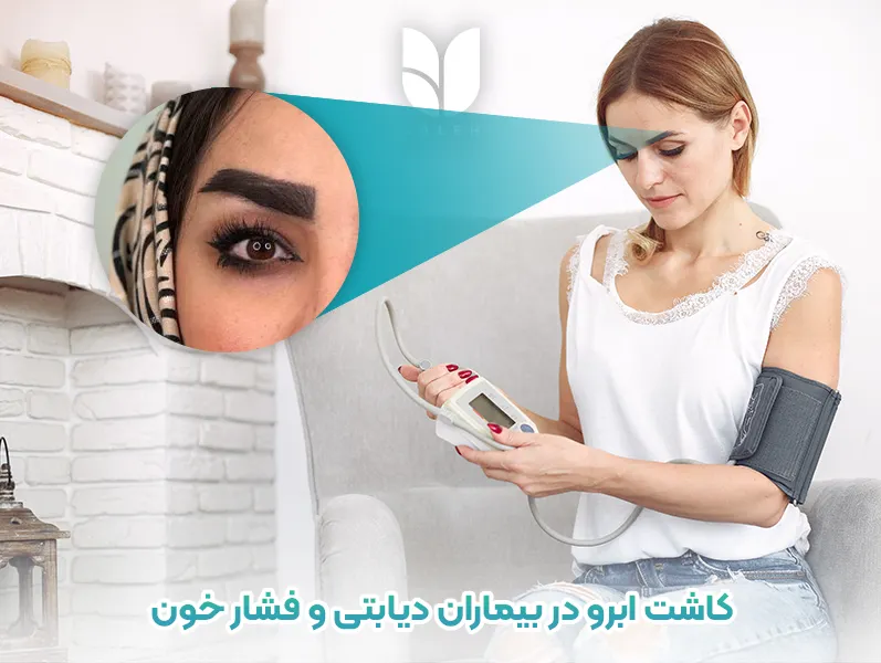 کاشت ابرو در بیماران دیابتی و فشار خون