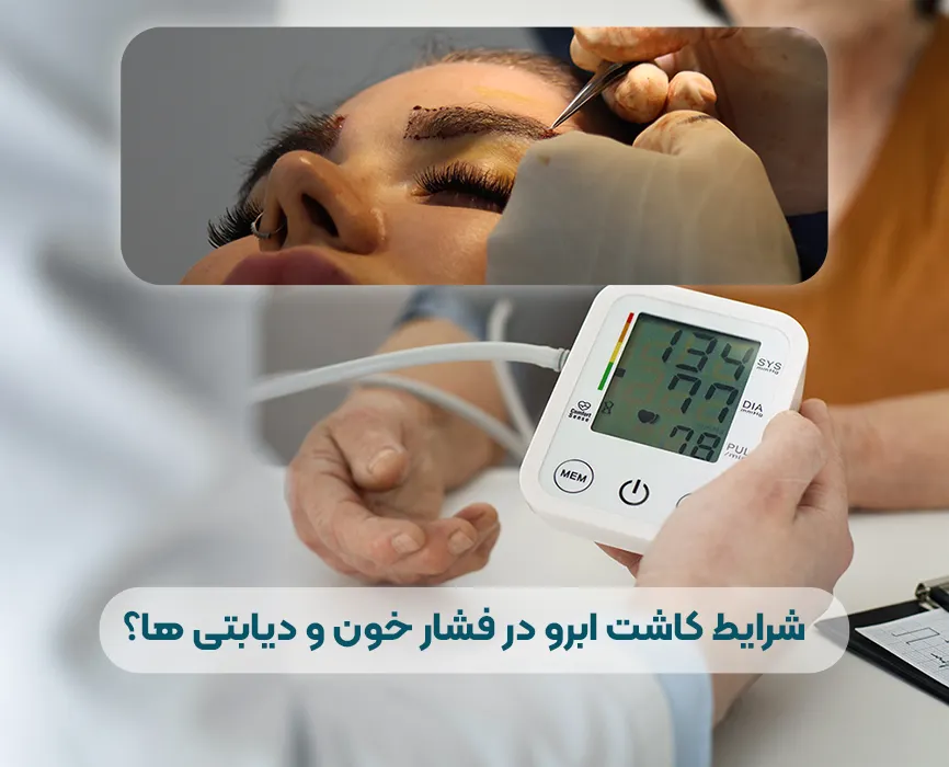 کاشت ابرو در بیماران دیابتی و فشار خون