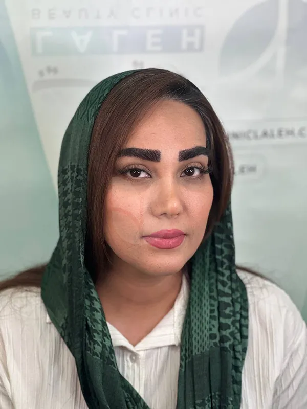 کاشت ابرو در کلینیک لاله