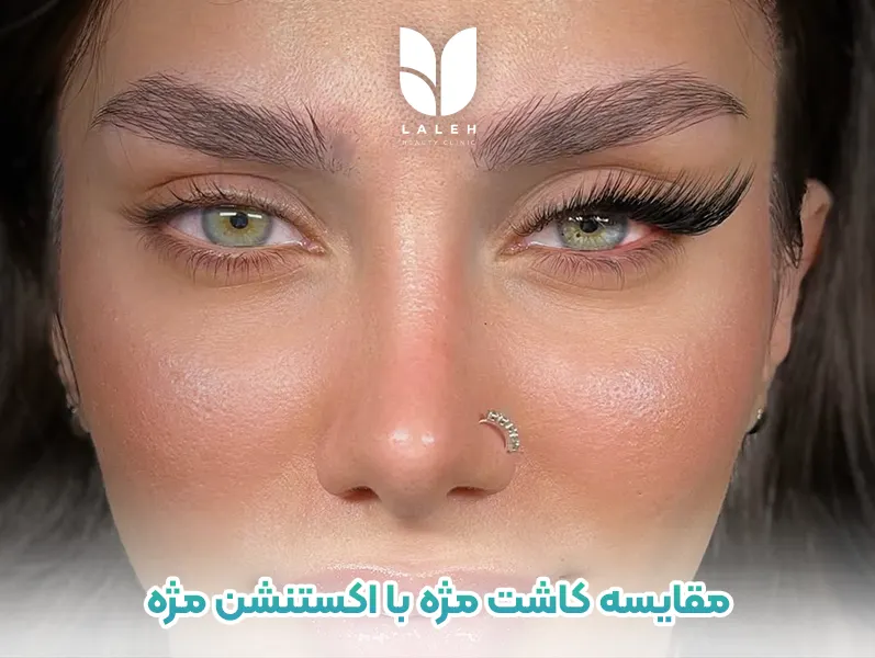 مقایسه صادقانه کاشت مژه دائمی با اکستنشن مژه