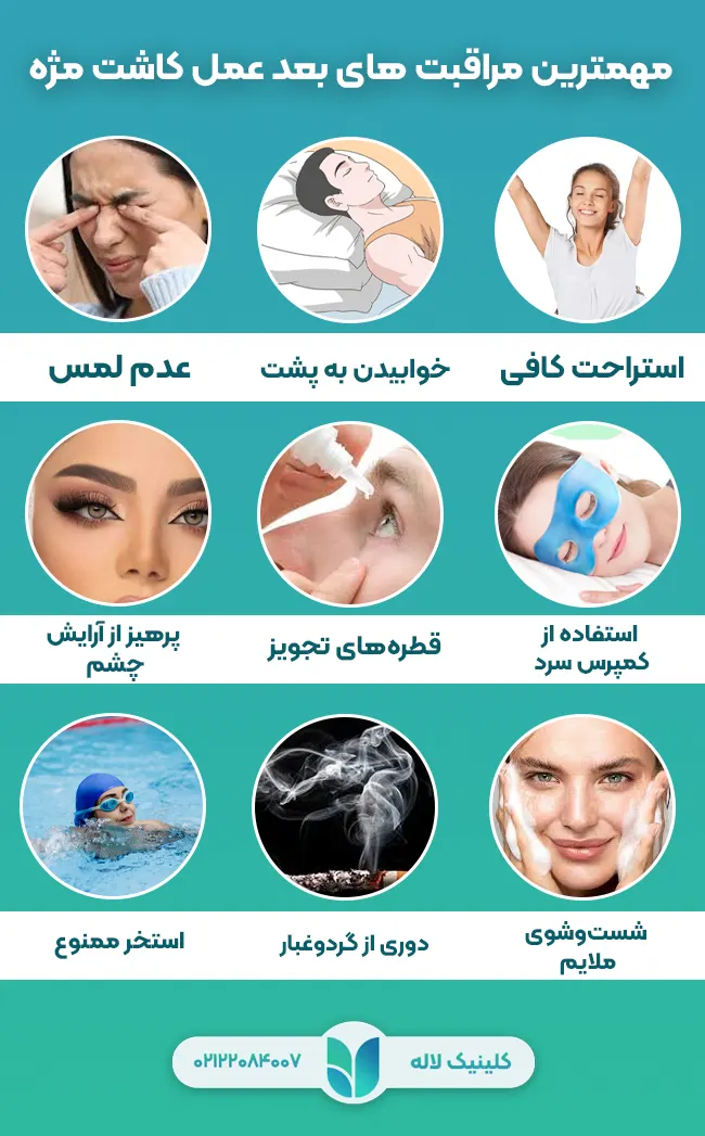 مراقبت های بعد از کاشت مژه