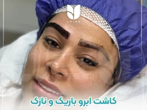 کاشت ابرو باریک و نازک در کلینیک لاله