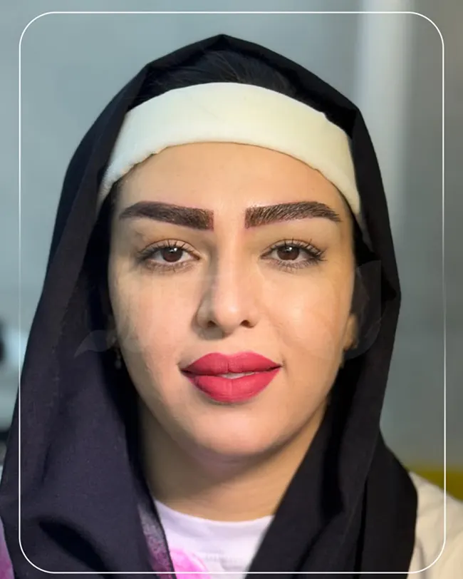 کاشت ابرو باریک و نازک