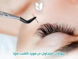 سوالات متداول در مورد کاشت مژه