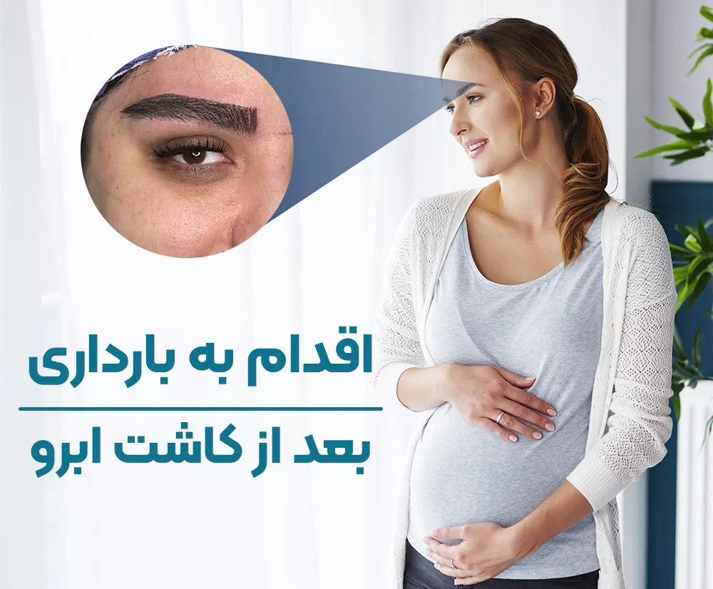 اقدام به بارداری بعد از کاشت ابرو