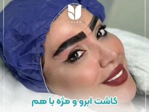 کاشت دائمی ابرو و مژه با هم