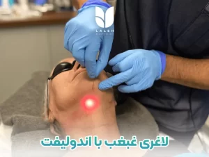 لاغری و لیفت غبغب با اندولیفت