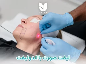 اندولیفت صورت