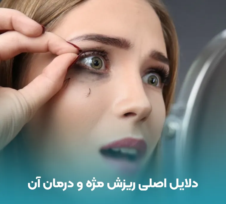 ریزش مژه