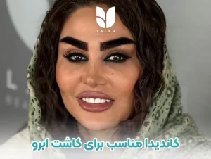 کاندیدا مناسب برای کاشت ابرو
