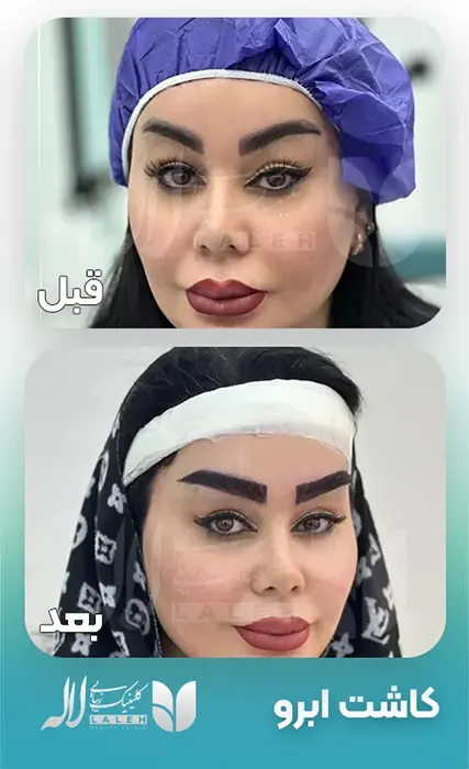 ghabl-bad-kasht-abrow-1