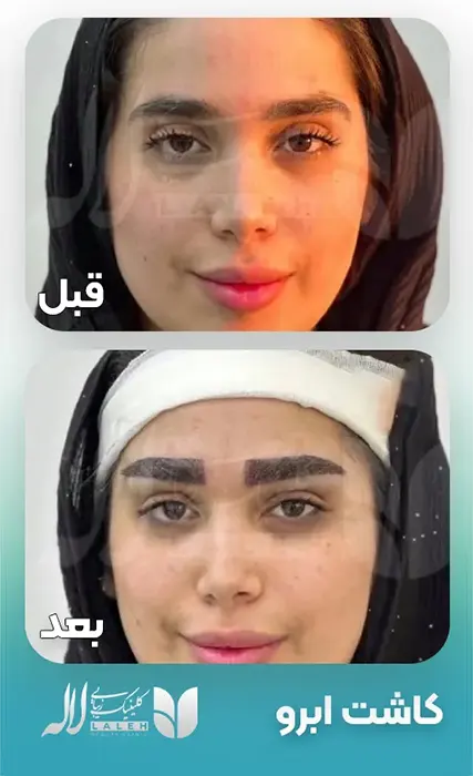 ghabl-bad-kasht-abrow-2