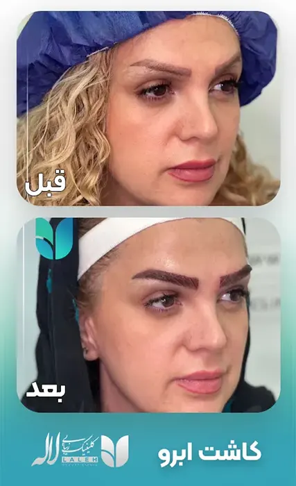 kasht-abrow-laleh-06