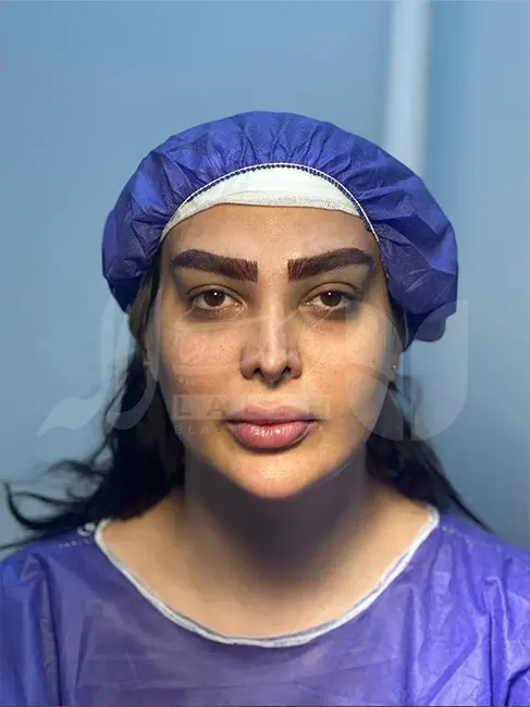 kasht-eyebrow-16 (1)