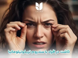 کاشت مژه و ابرو در افراد با سندروم تریکوتیلومانیا