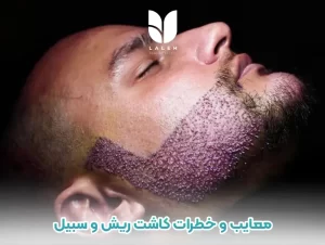 معایب و خطرات کاشت ریش و سبیل