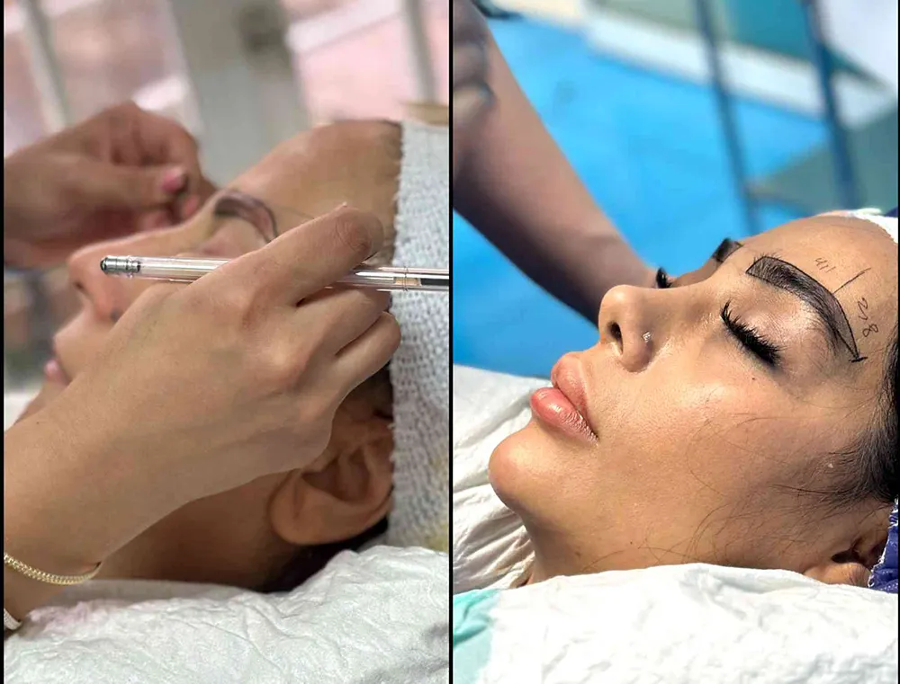 نحوه کاشت به روش میکروکاشت