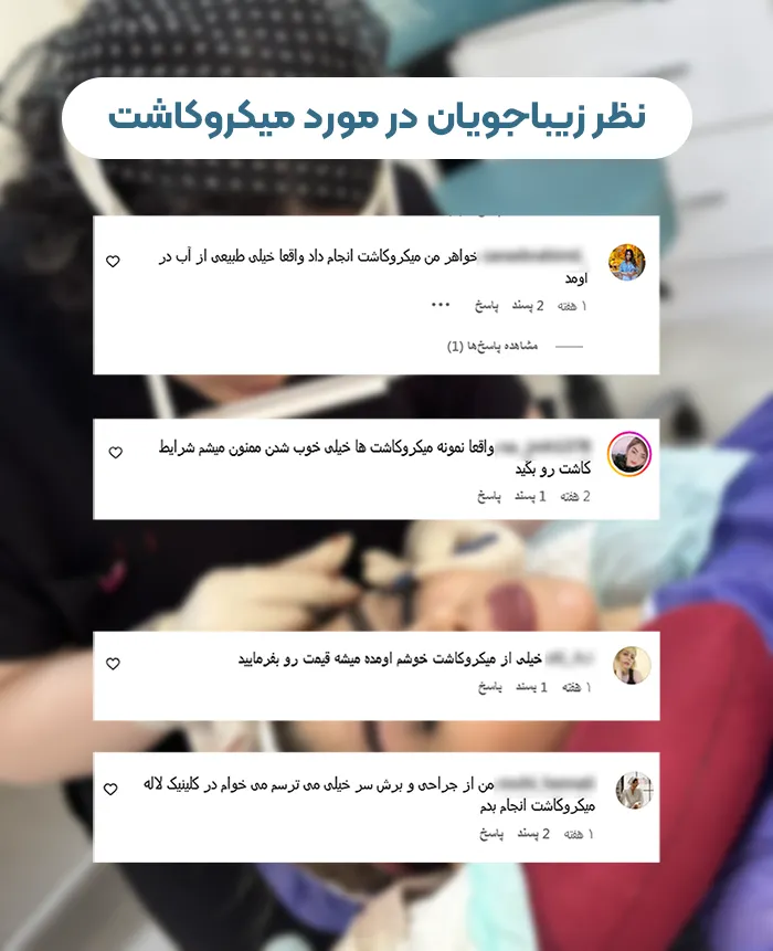 نظر مراجعه کنندگان در مورد میکروکاشت