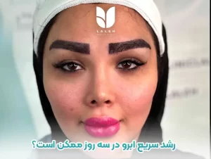 رشد سریع ابرو در سه روز ممکن است؟