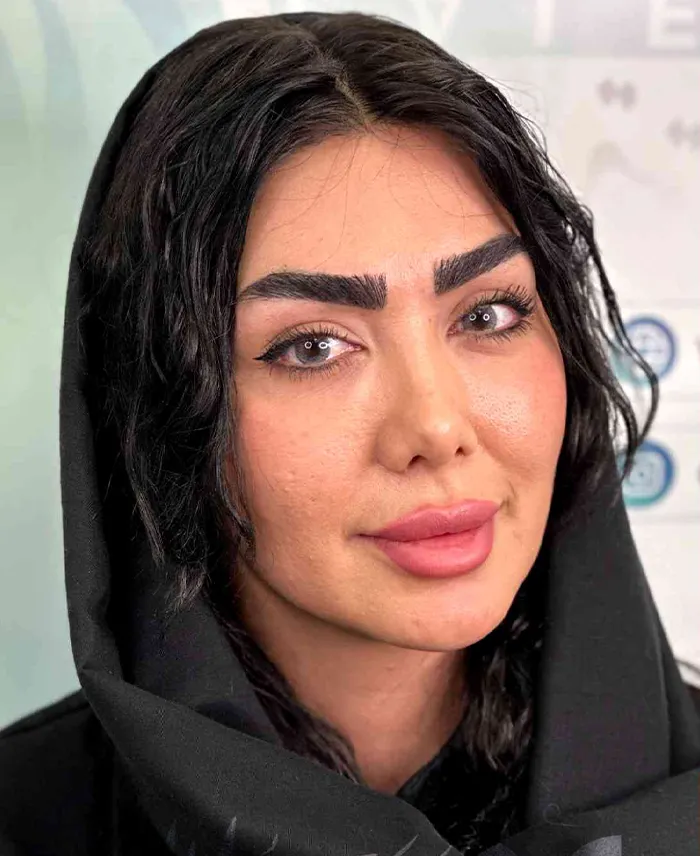 کاشت ابرو لاله