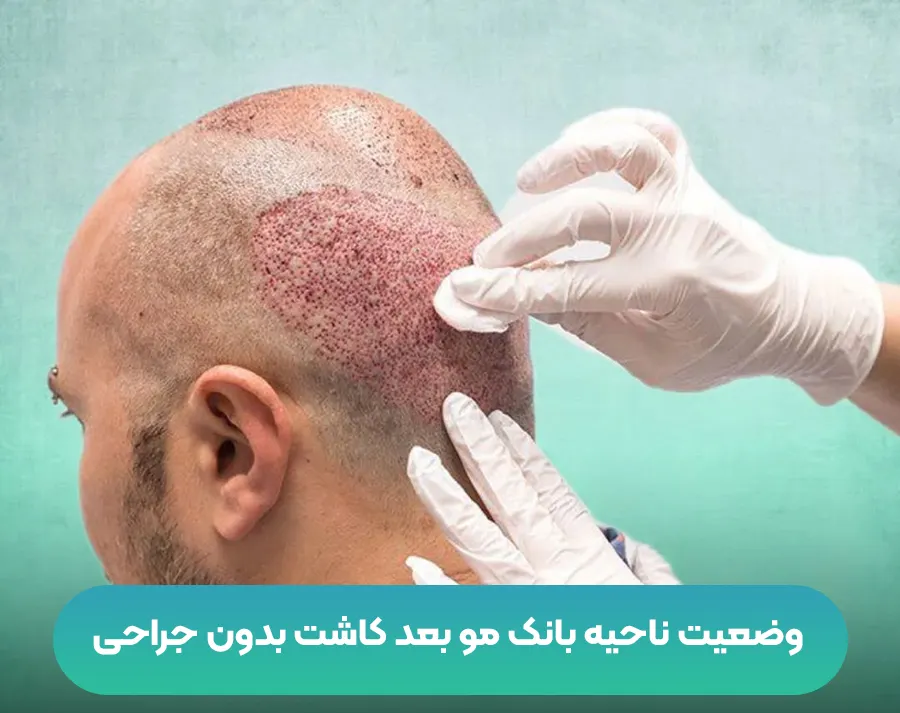 بانک مو پشت سر