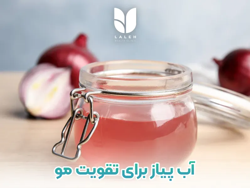 آب پیاز برای تقویت مو