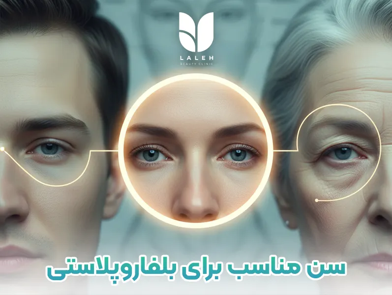 بهترین سن برای عمل بلفاروپلاستی