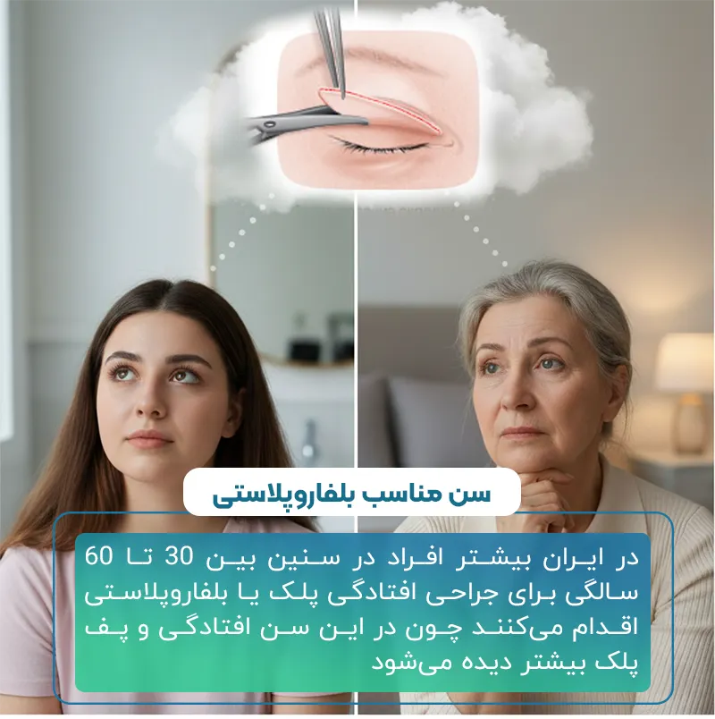 بهترین سن برای بلفاروپلاستی