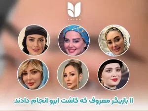 11 بازیگر معروف که کاشت ابرو انجام دادند
