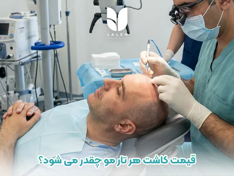 قیمت کاشت هر تار مو چقدر می شود؟