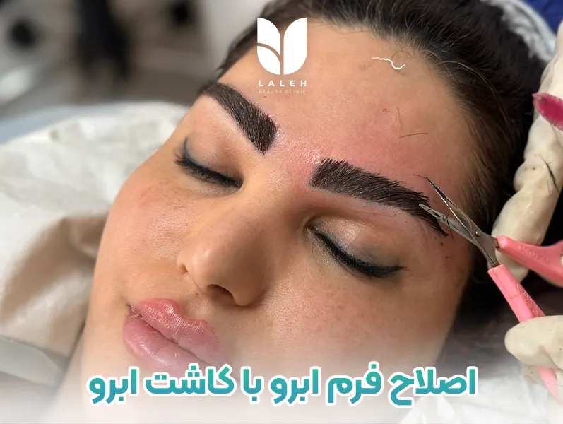 اصلاح طبیعی فرم ابرو با کاشت ابرو