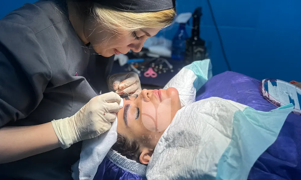 کاشت ابرو در اهواز