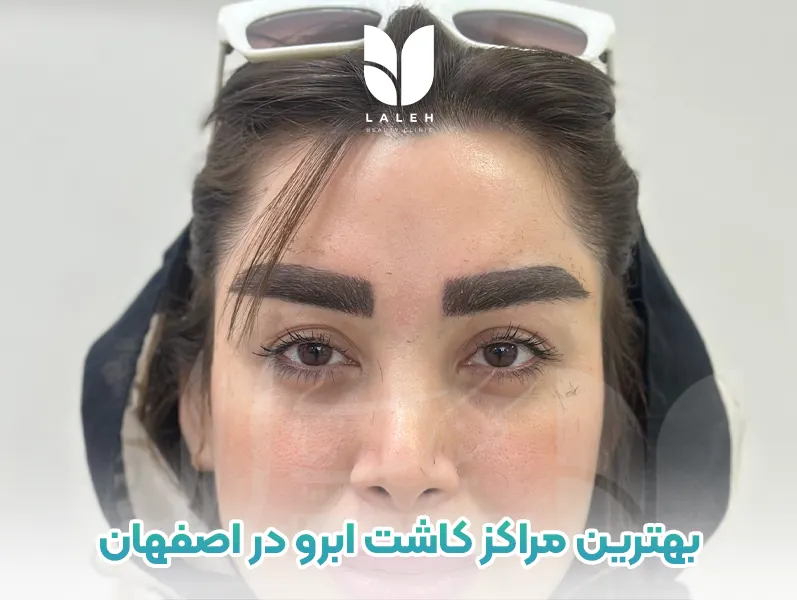 بهترین مراکز کاشت ابرو در اصفهان
