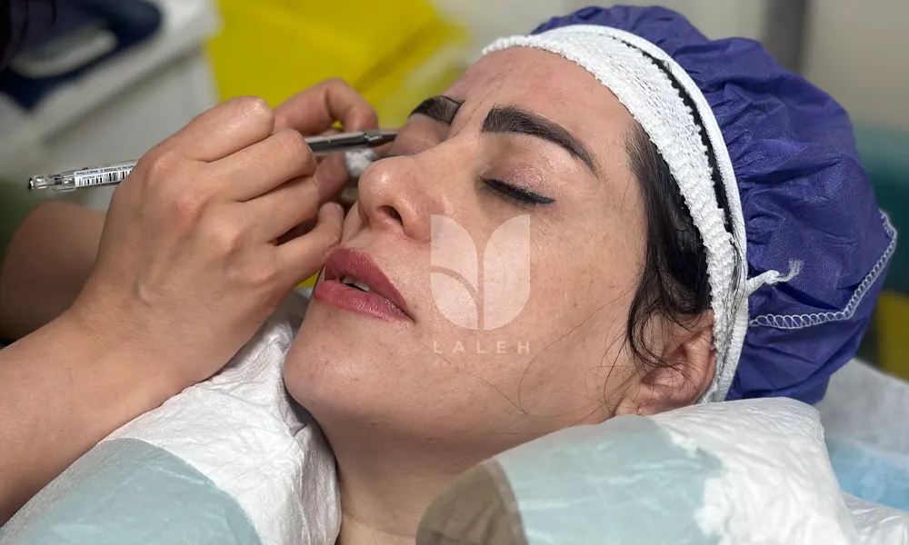 بهترین مراکز کاشت ابرو در اصفهان