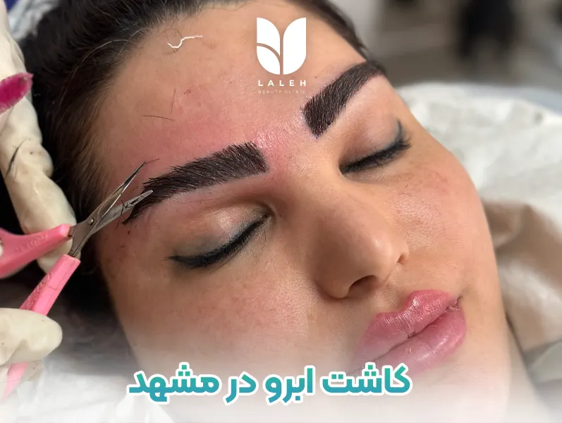 کاشت ابرو در مشهد
