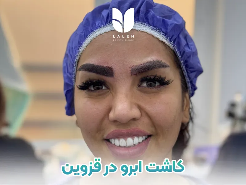 کاشت ابرو در قزوین