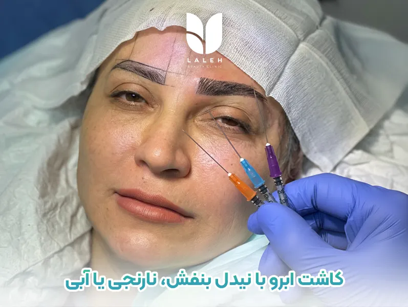 کاشت ابرو با نیدل بنفش، نارنجی یا آبی