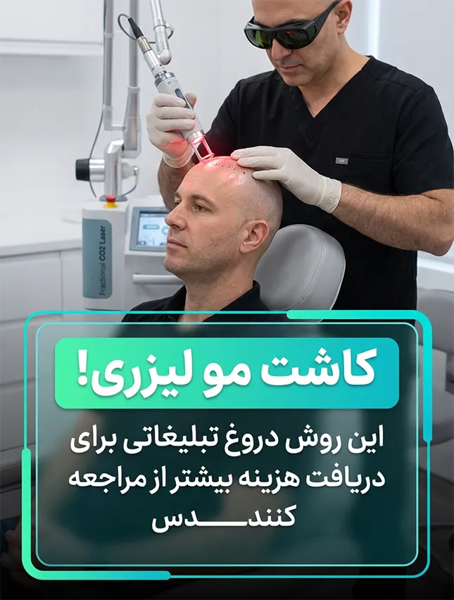 کاشت مو لیزری