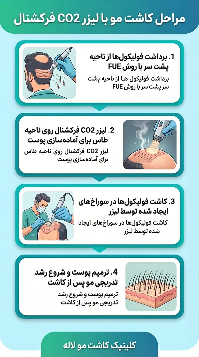 مراحل کاشت مو با لیزر co2 فرکشنال