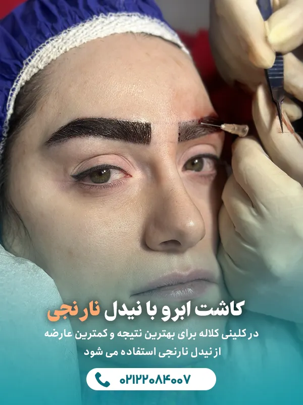 کاشت ابرو با نیدل نارنجی